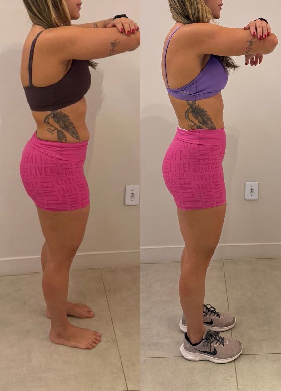 Transformação em 2 meses — antes e depois