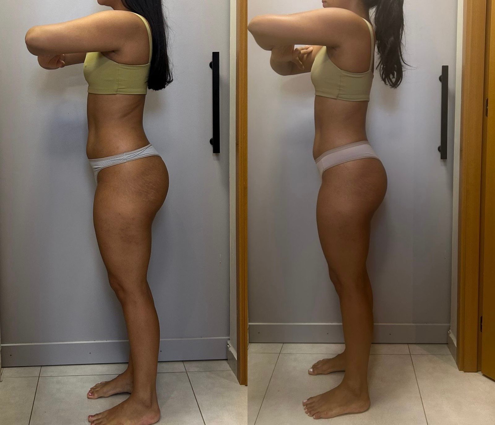 Transformação em 2 meses — antes e depois