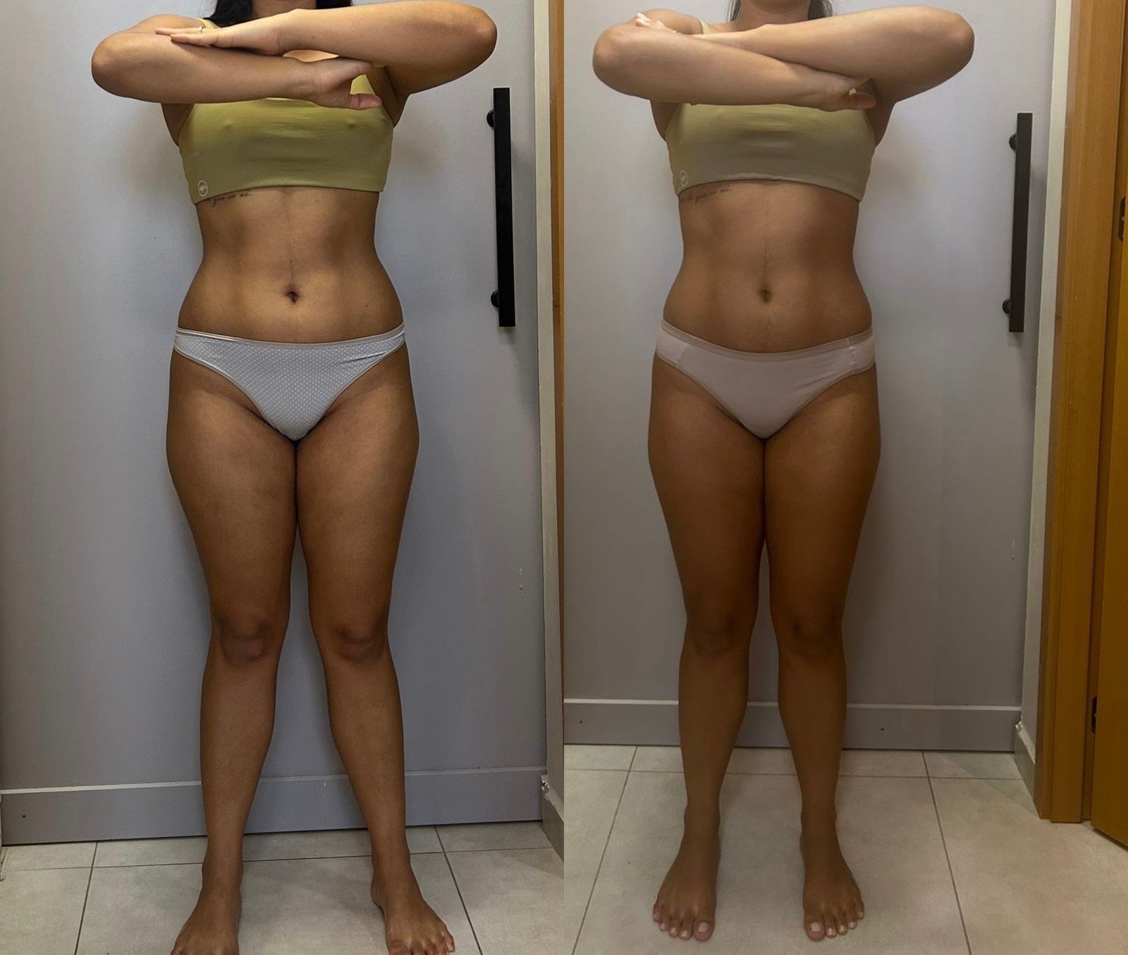 Transformação em 2 meses — antes e depois
